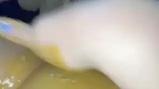 فرج وردي شاب يُحشى بعلاج حلو غريب في الولايات المتحدة الأمريكية